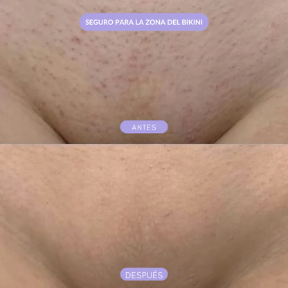 Borrador de Vello Smud