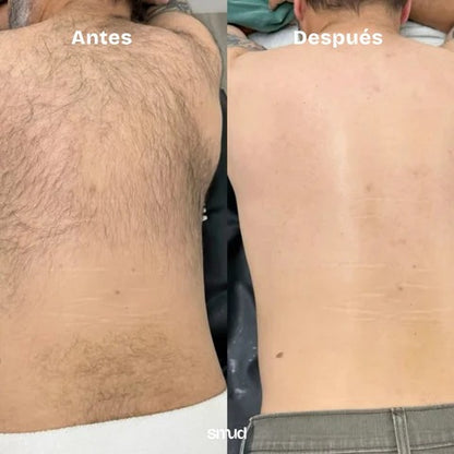 Borrador de Vello Smud Black